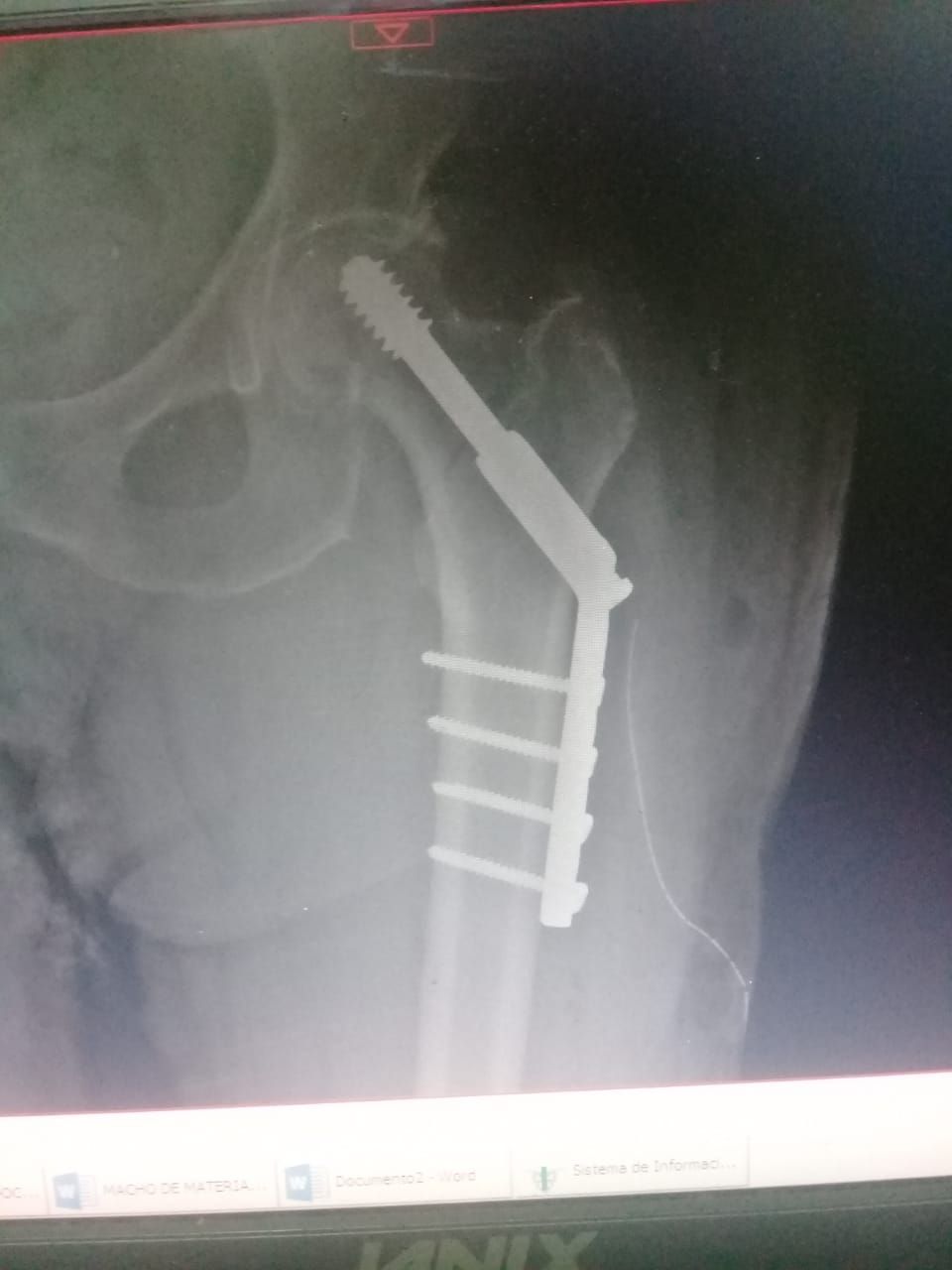 Juan José Luévano De La Cruz-5