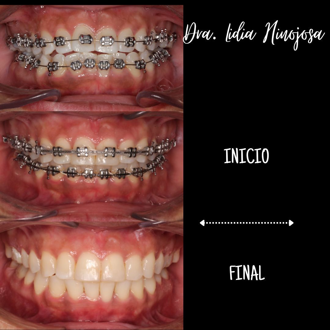 Lidia Abigail Hinojosa Arellanes-18