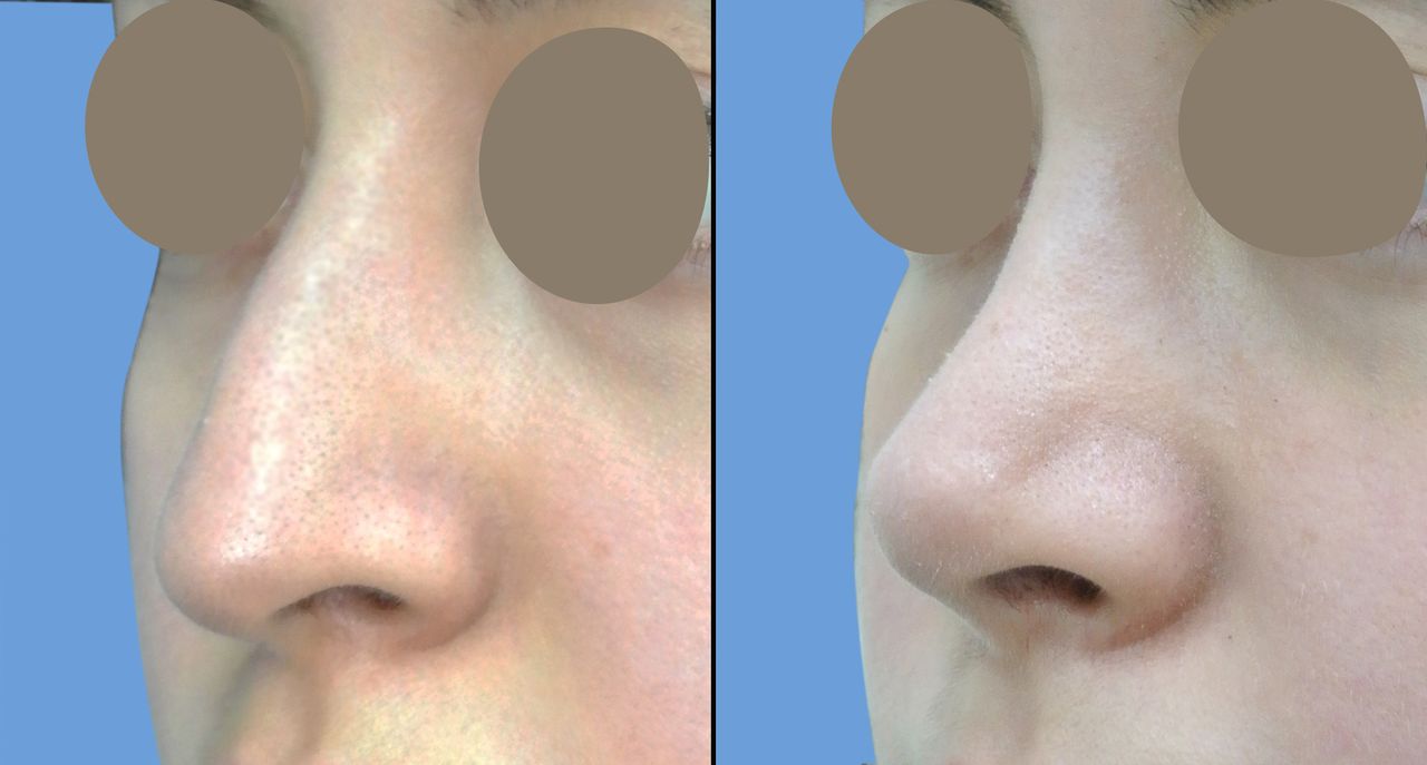 Ruby Lizardo Ramírez Robles-26