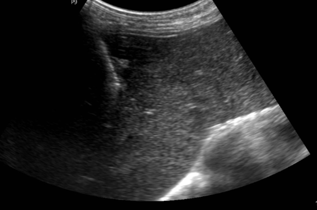 Luis Alonzo Briseño Salas-5