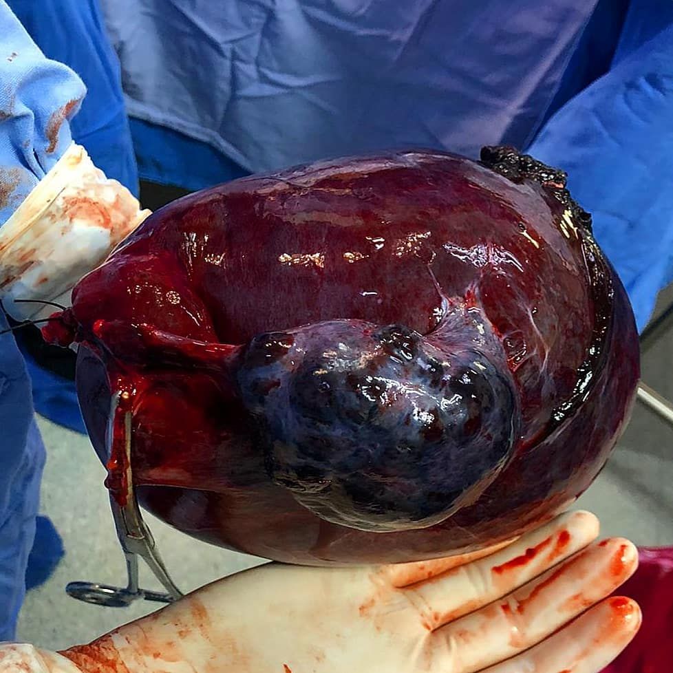 Edgar Alan De León Rojas-14