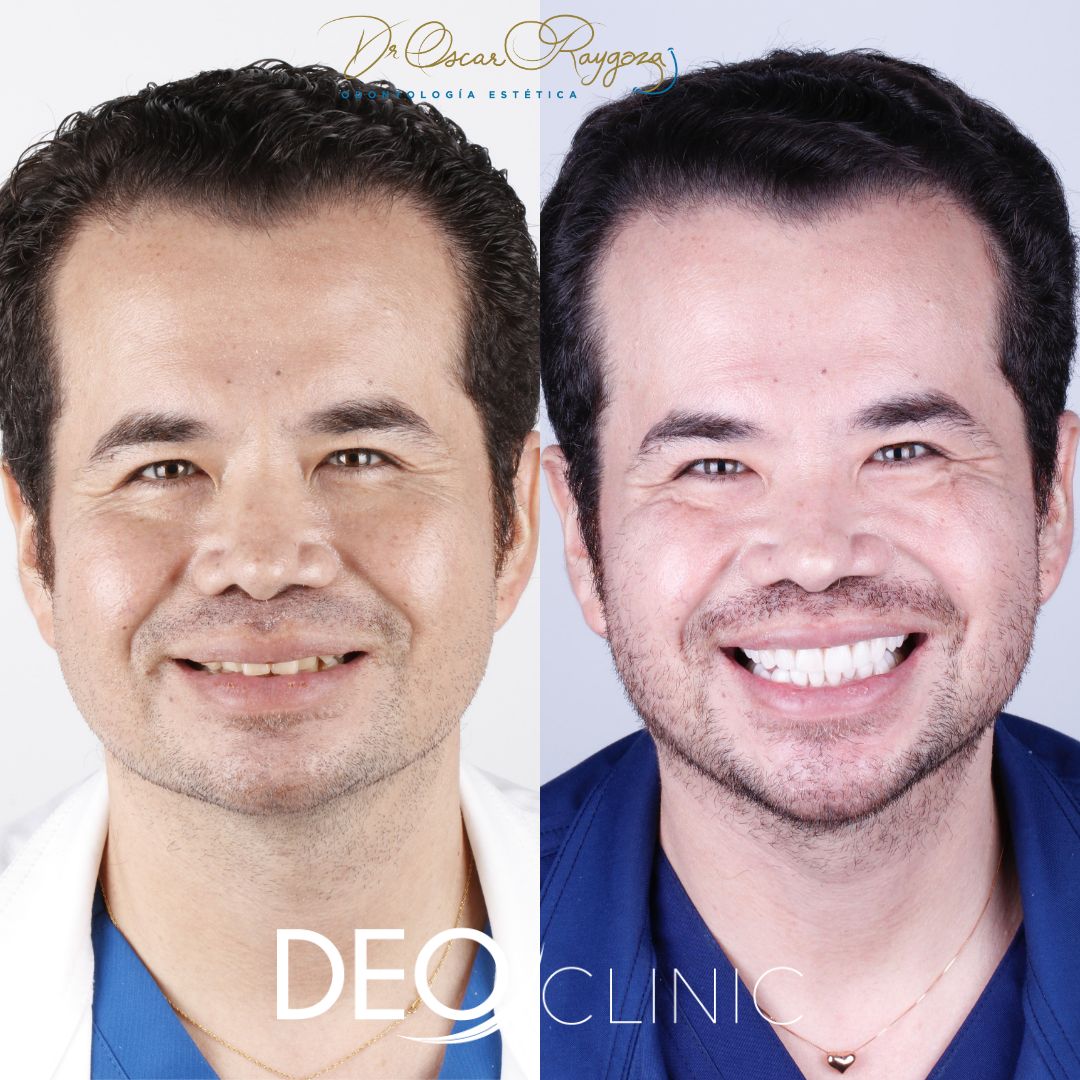 Oscar Raygoza Carrillo-25