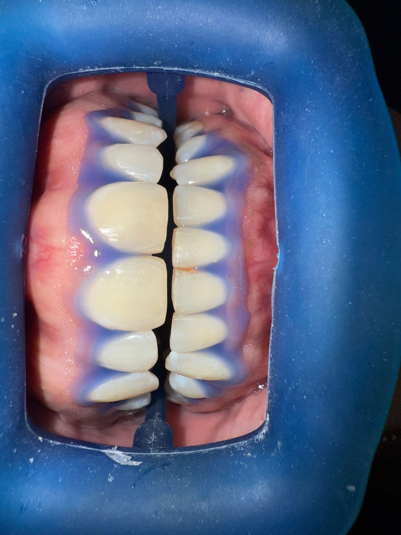 Jair Contreras García-56