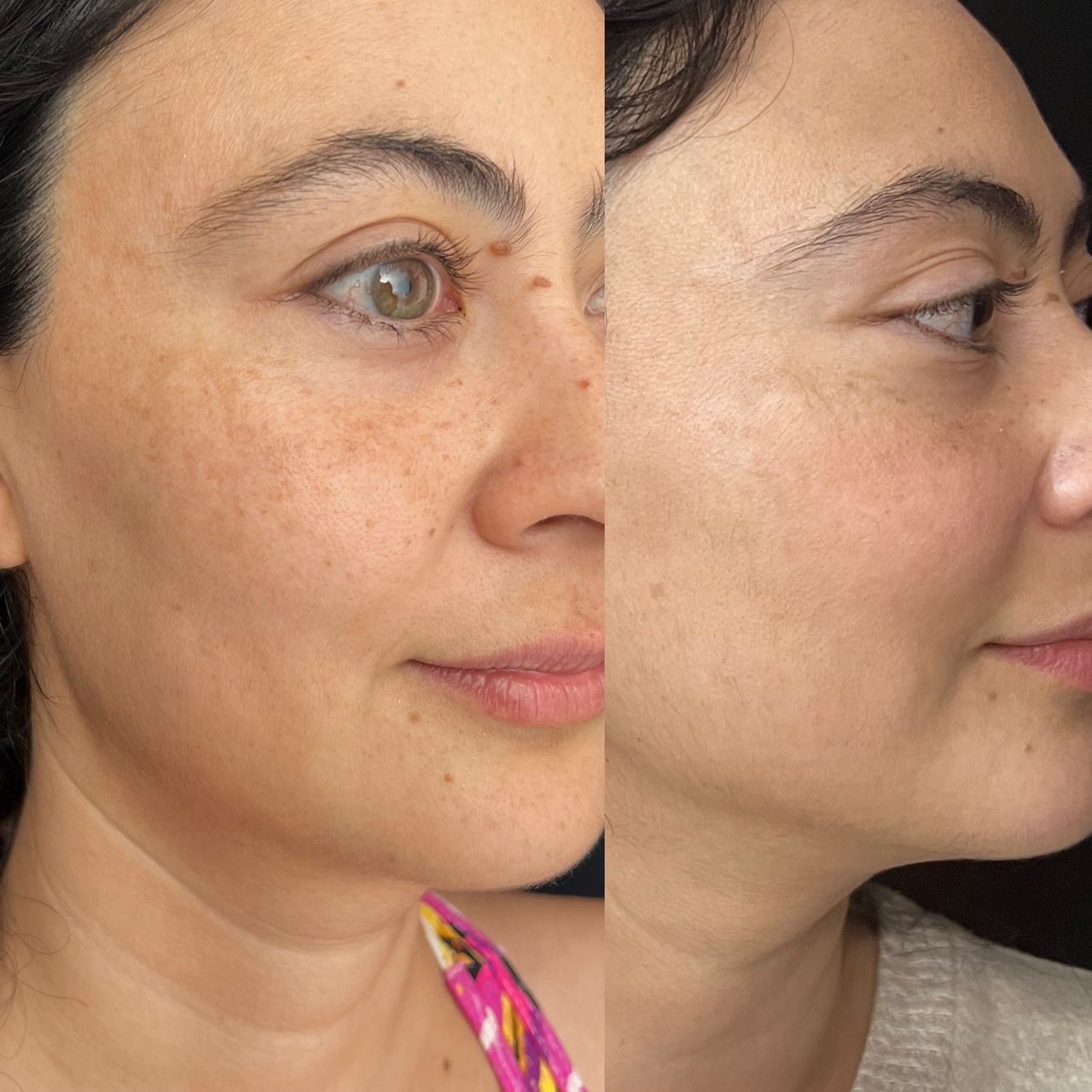 Venecia Landini Enríquez-7