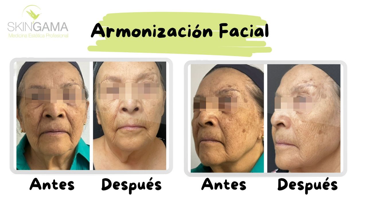 Juan Herrera Hernández-59