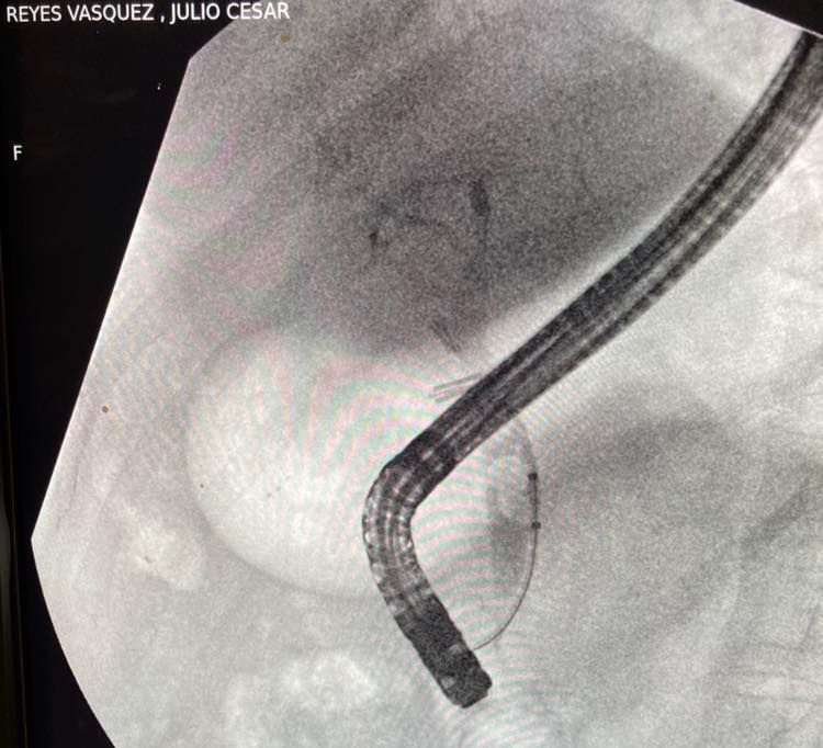 J. César Reyes Vásquez-13