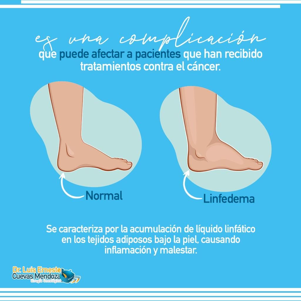 Luis Ernesto Cuevas Mendoza-201