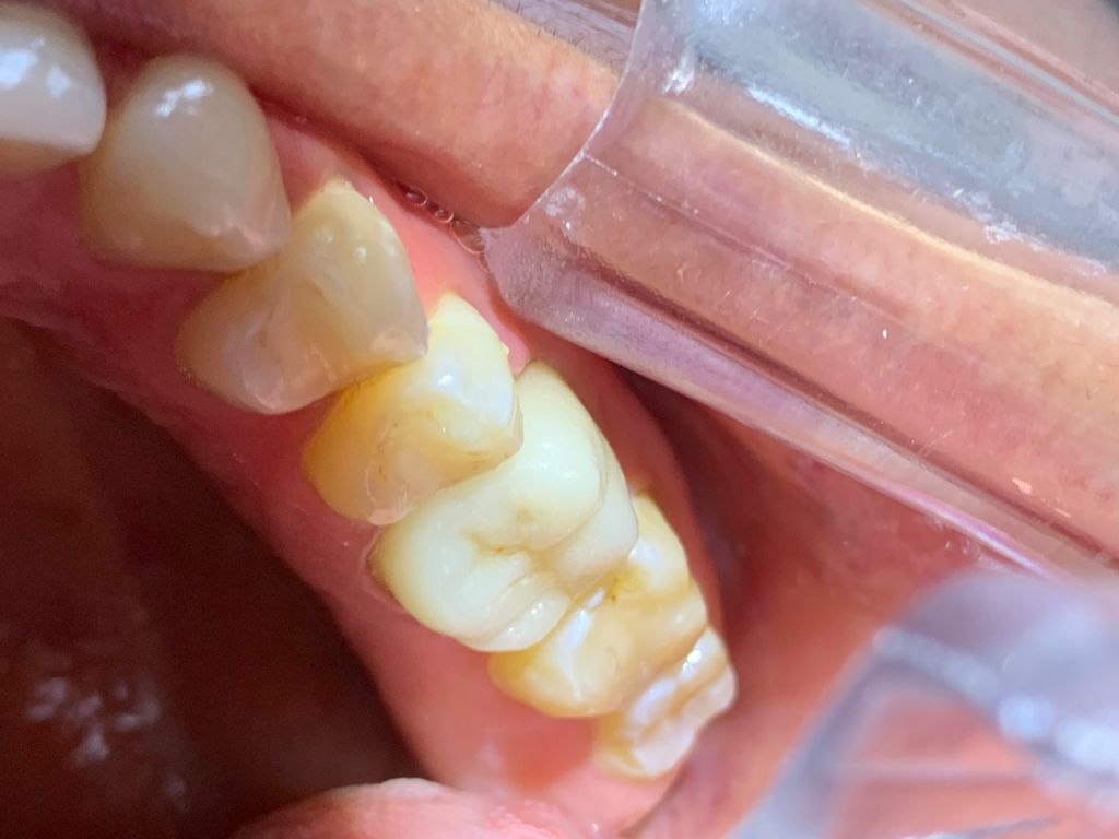 Yuriria Gochy Escalante-9