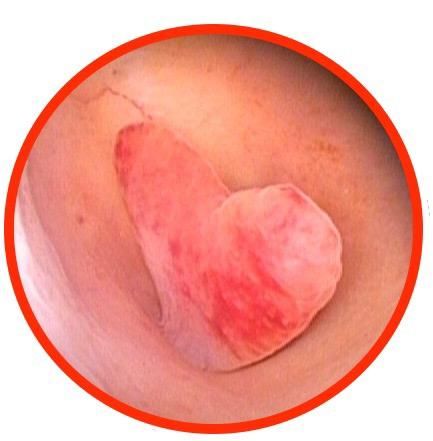 Brenda Anaid Torres Ugalde-15