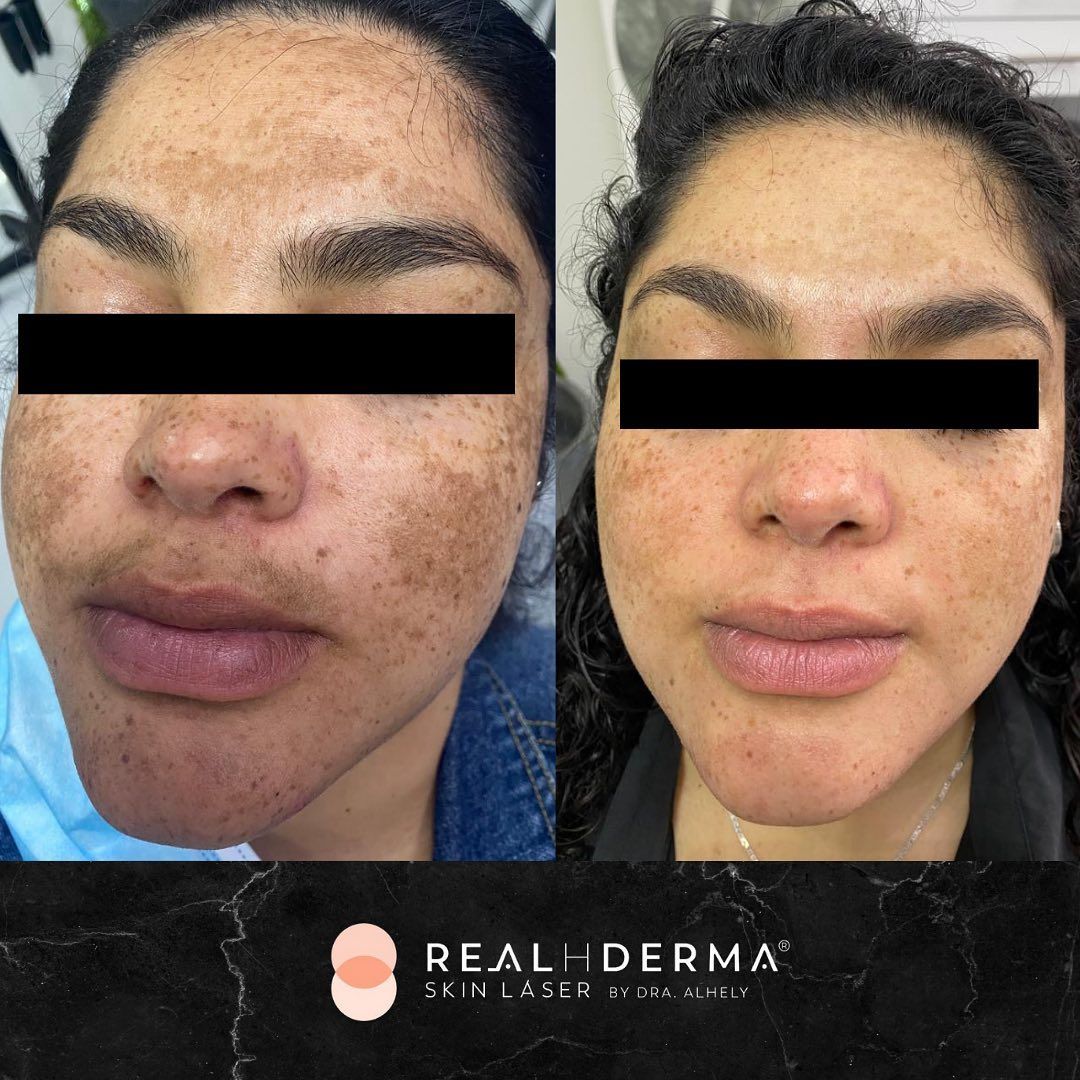 Laura Alheli Niebla Maldonado-11