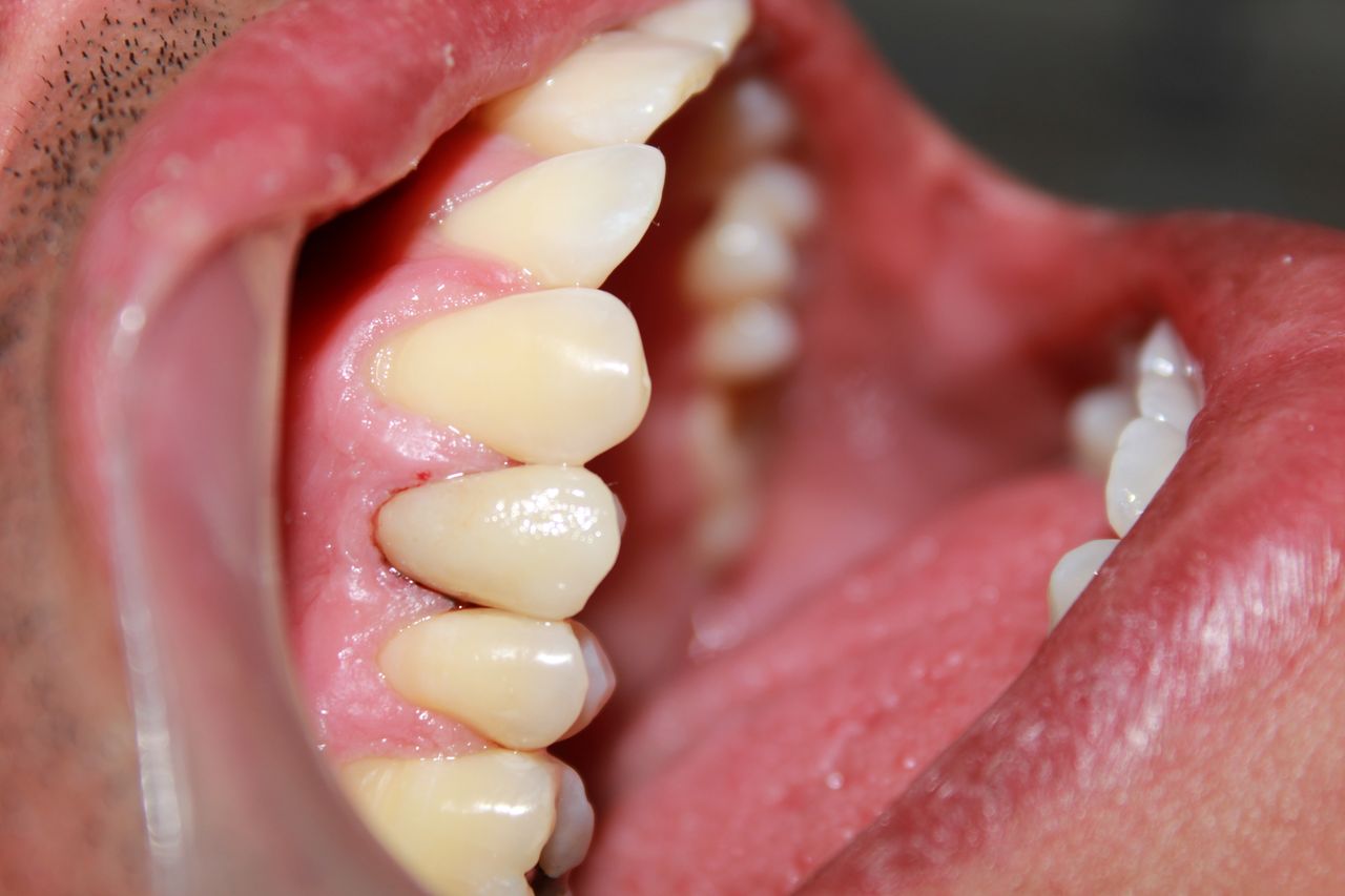 Alberto Guzmán Bravo-15