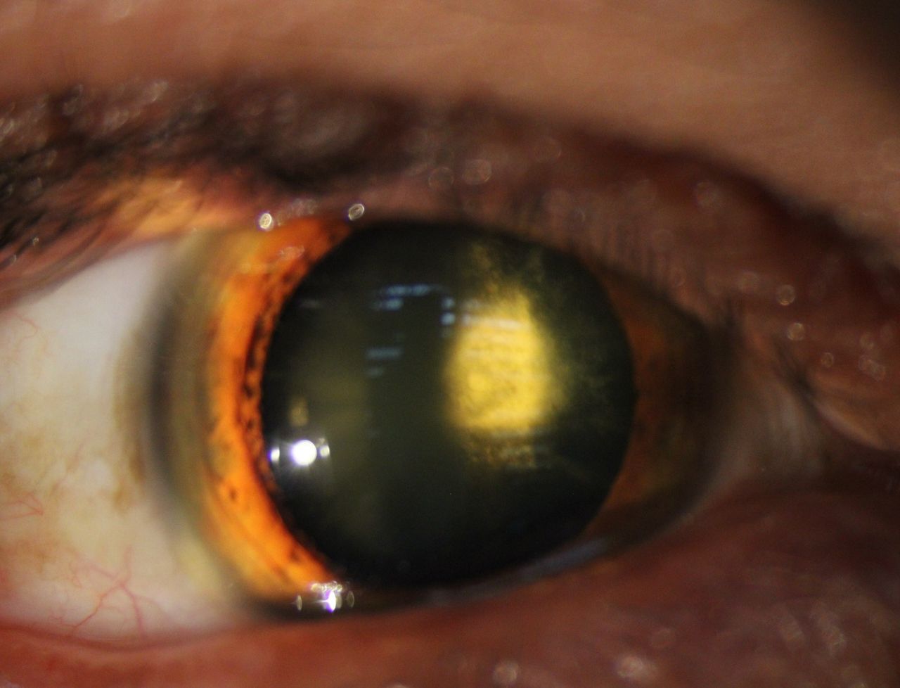 Kalid Barush Hernández Diaz-12