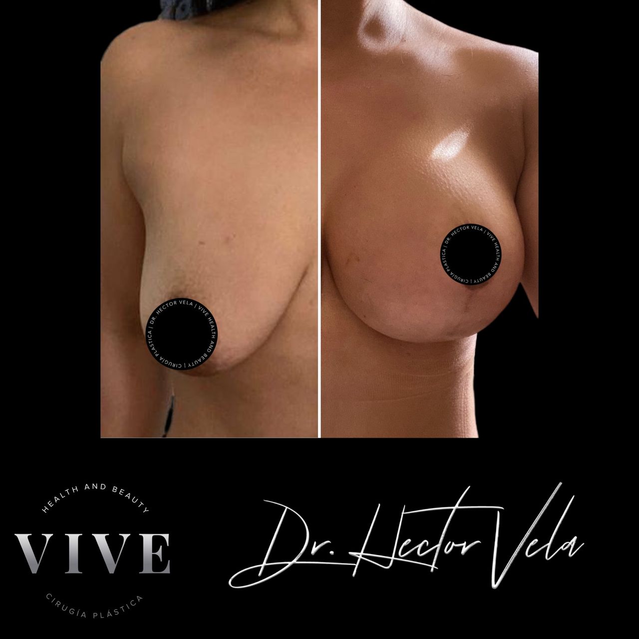 Héctor Eduardo Vela Cardona-159