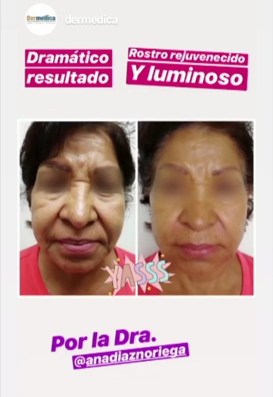 Ana Díaz Noriega-17