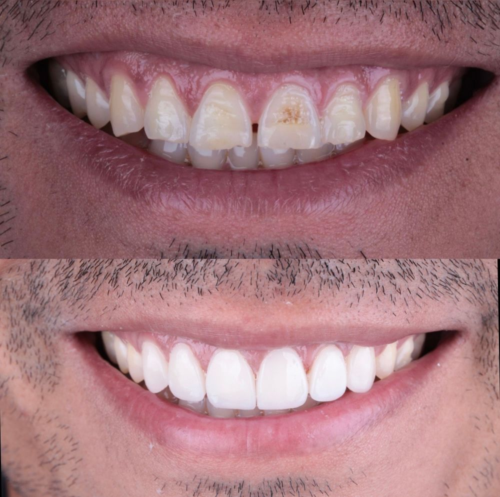 Laura Ceballos Brito-3