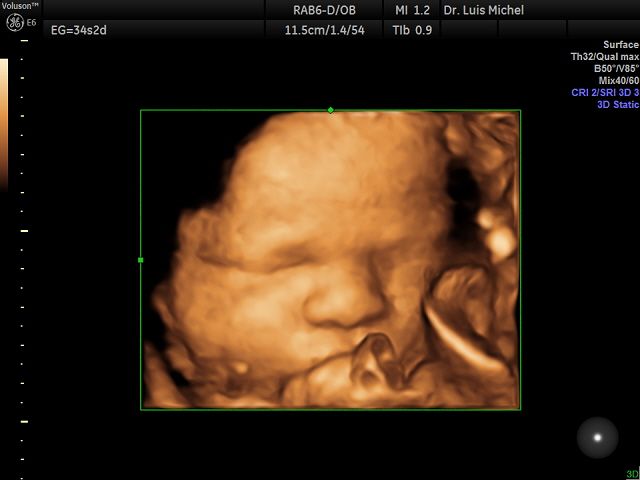 Luis Michel Fernandez-2