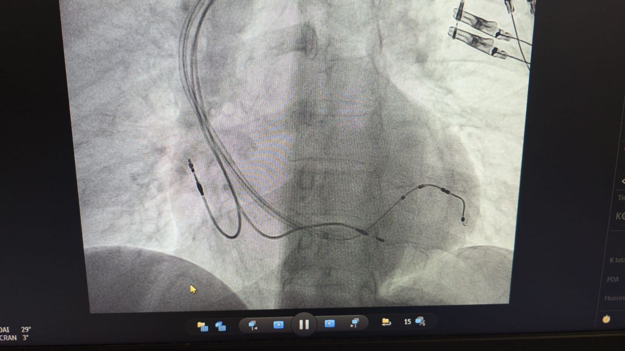 Juan Alberto Vargas Mejia-5