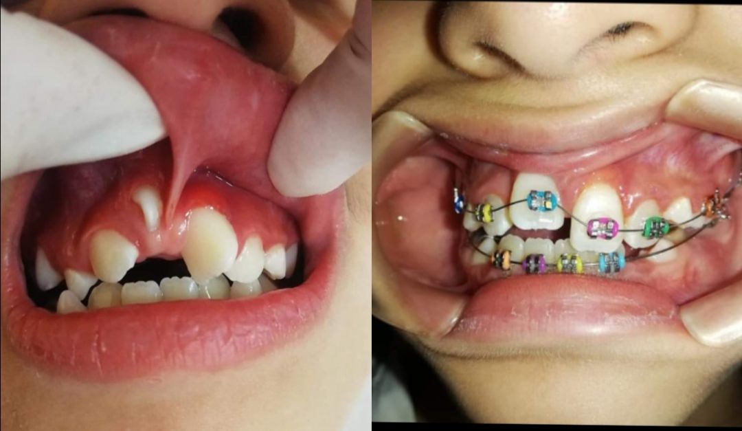 Stephanie Haydee Solis Carranco-1