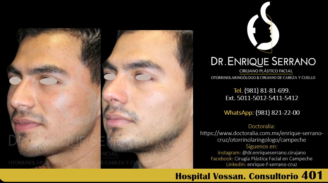 Enrique Serrano Cruz-100