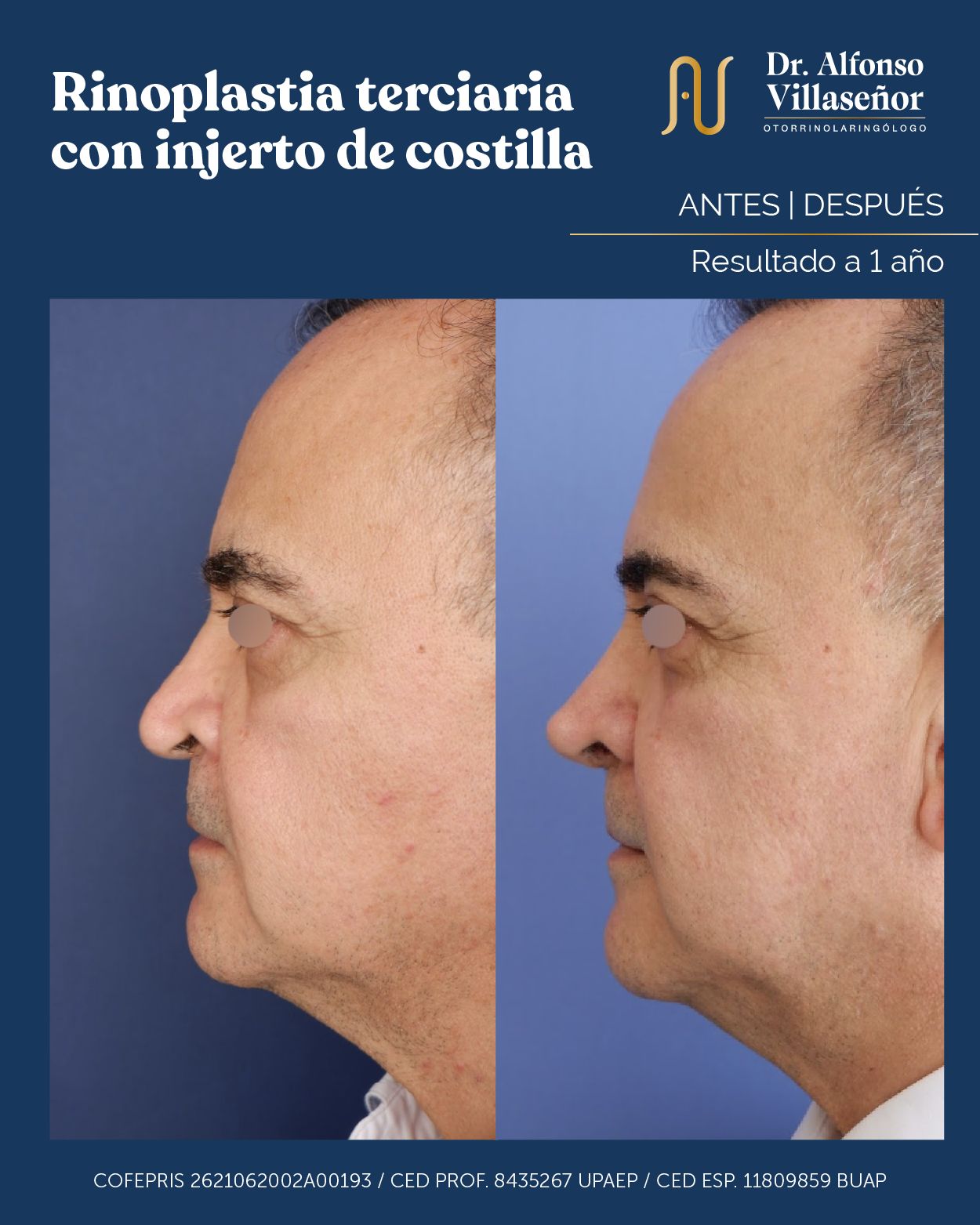 Alfonso Villaseñor Herrero-7