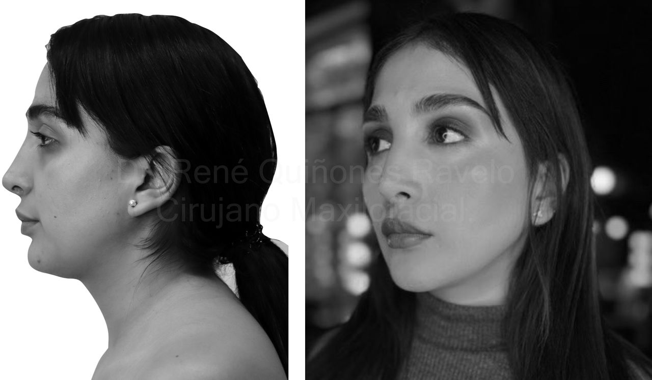 René Quiñones  Ravelo-2