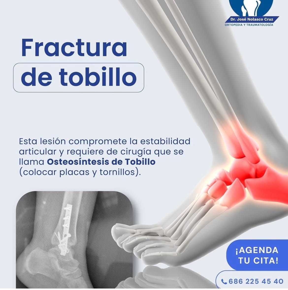 Jose Nolasco Cruz-11