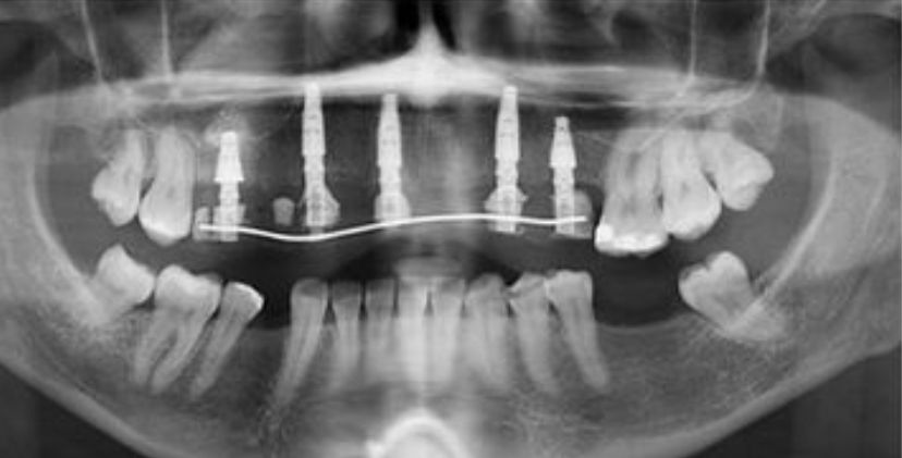 Erika Díaz De León Torres-4