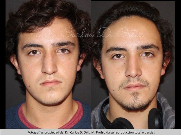 Carlos David Ortiz Moreno-16