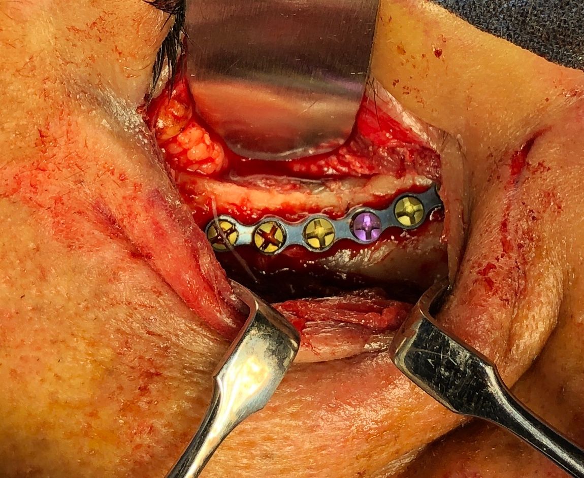 Luis Humberto Garcia Cabrera-7