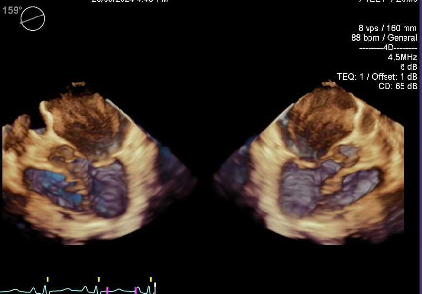 Luis Augusto Baeza Herrera-2