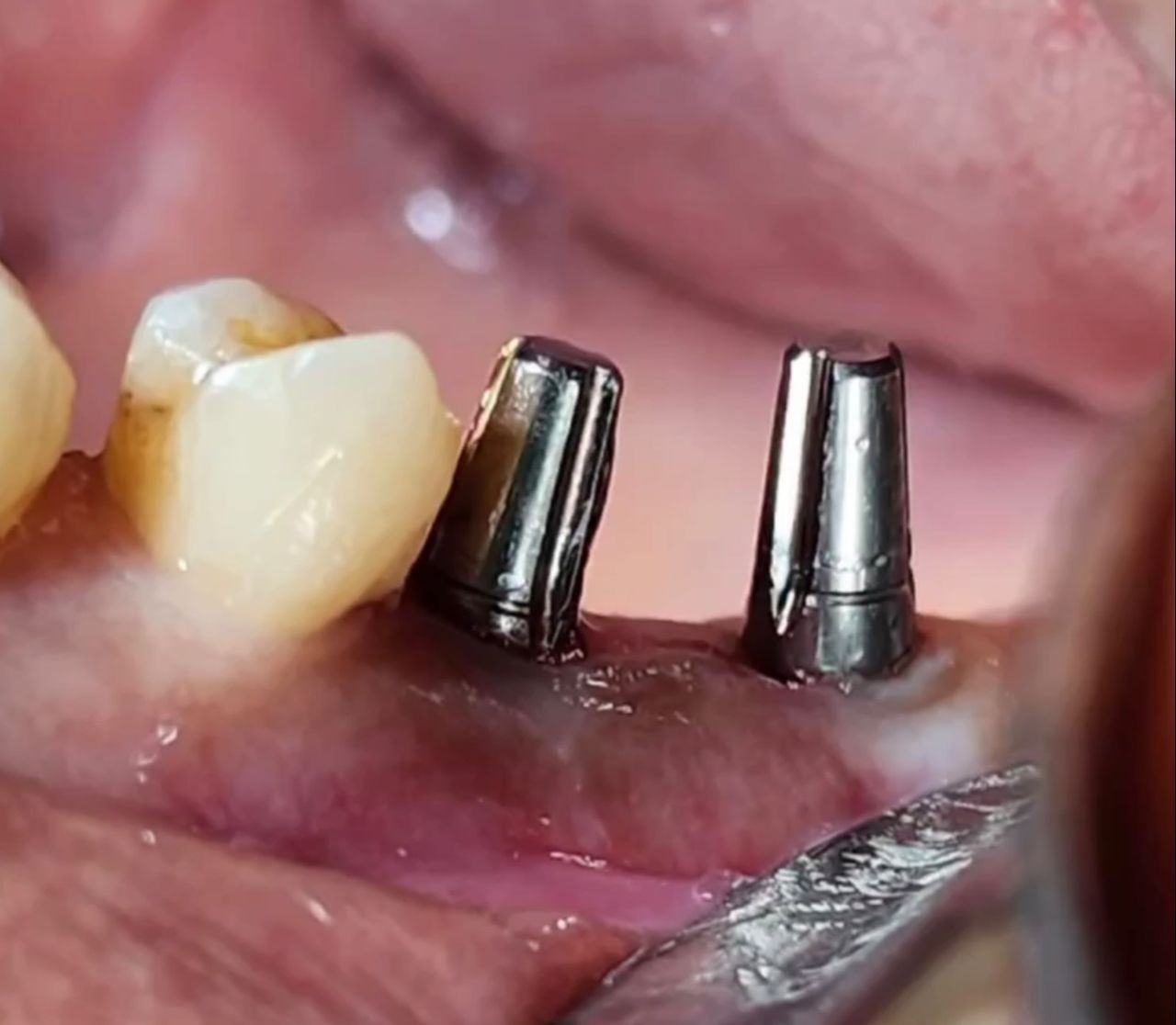 Miguel Ángel Cervantes Rodríguez-0