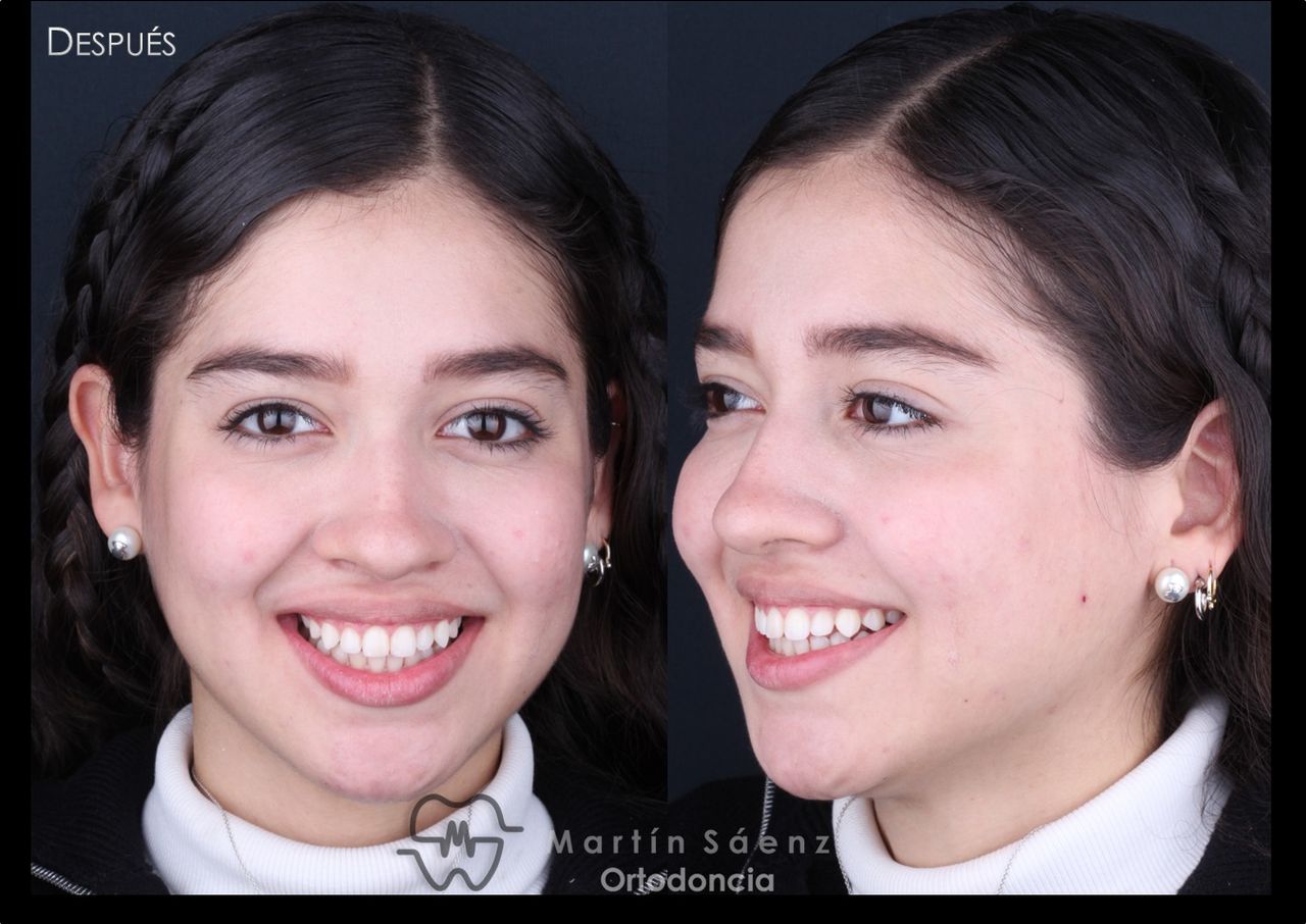 Martín Sáenz Zárate-11