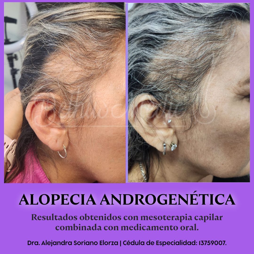 Alejandra Soriano Elorza-8