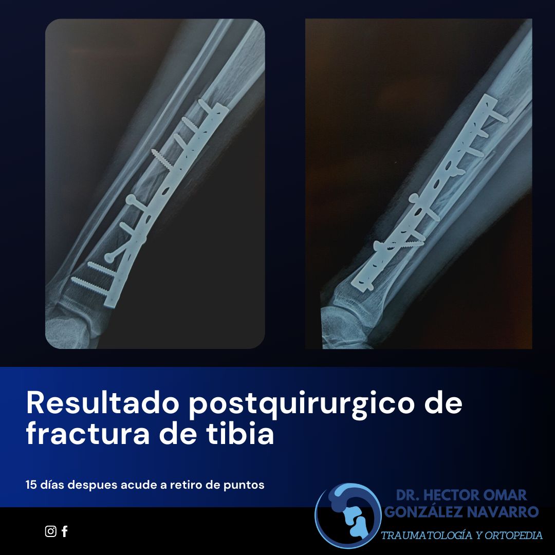 Héctor Omar González Navarro-1