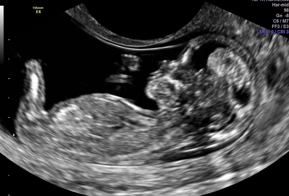 Alfredo Fernández-2