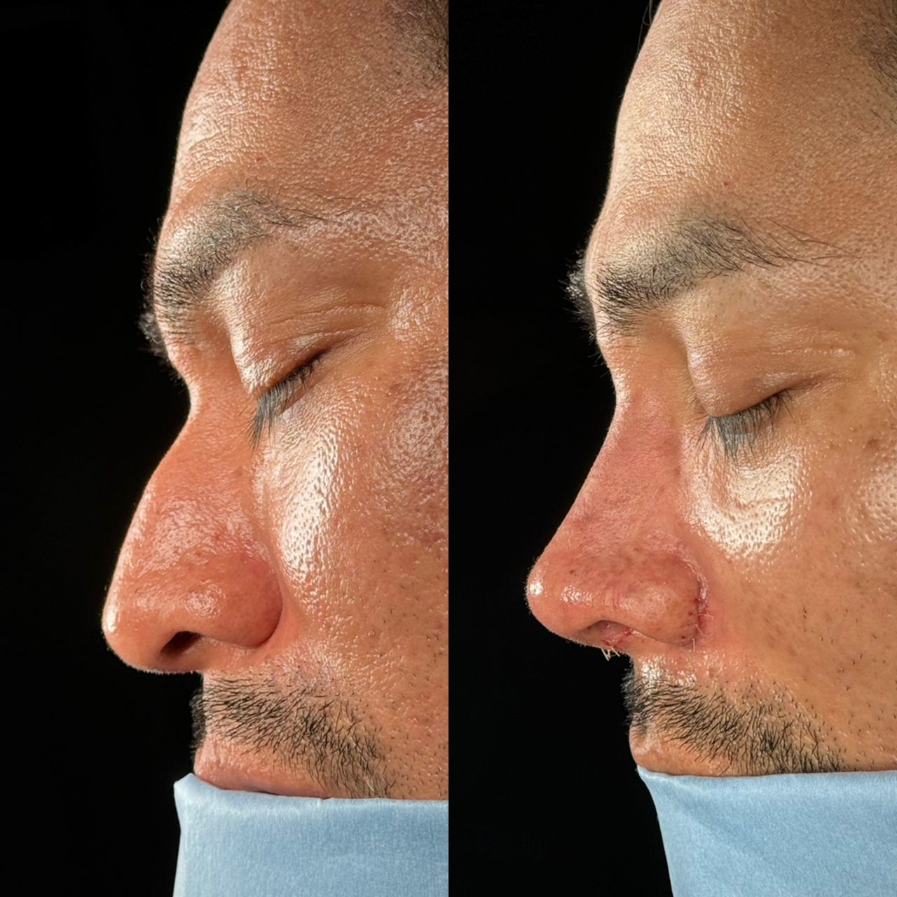 Angel Castro Urquizo-124