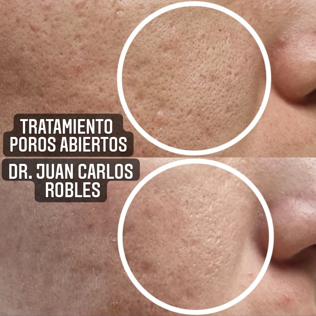 Juan Carlos Robles Méndez-12