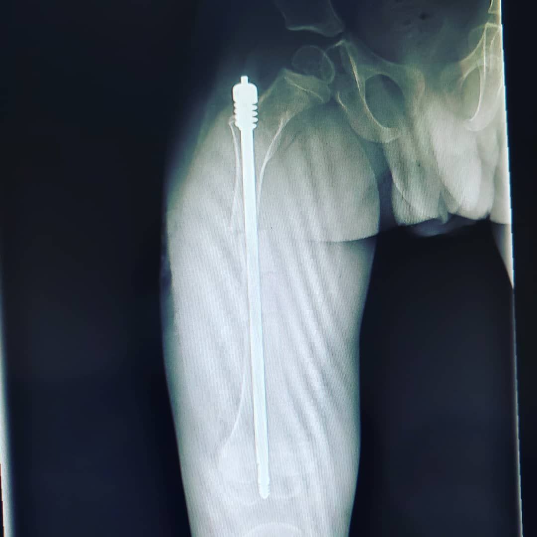 Alfonso Meza Vernis-79