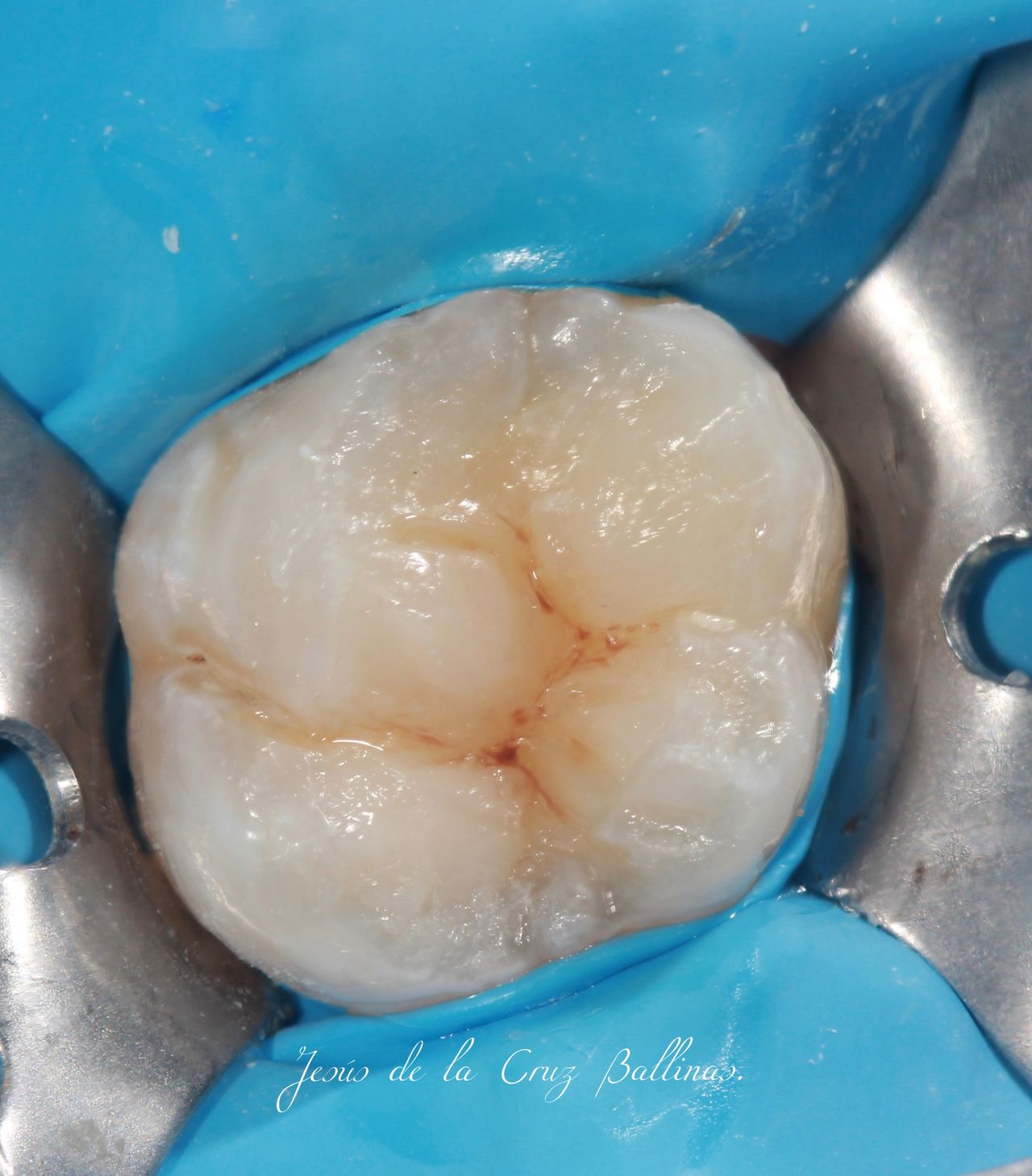 Jesus De La Cruz Ballinas-32