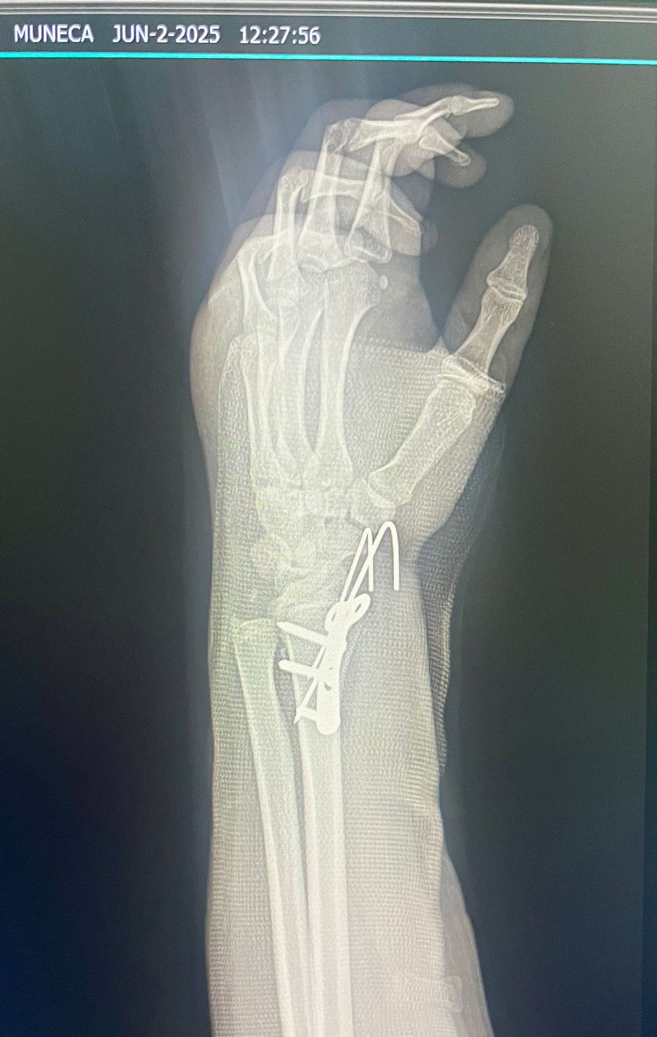 Rogelio Hernández García-51