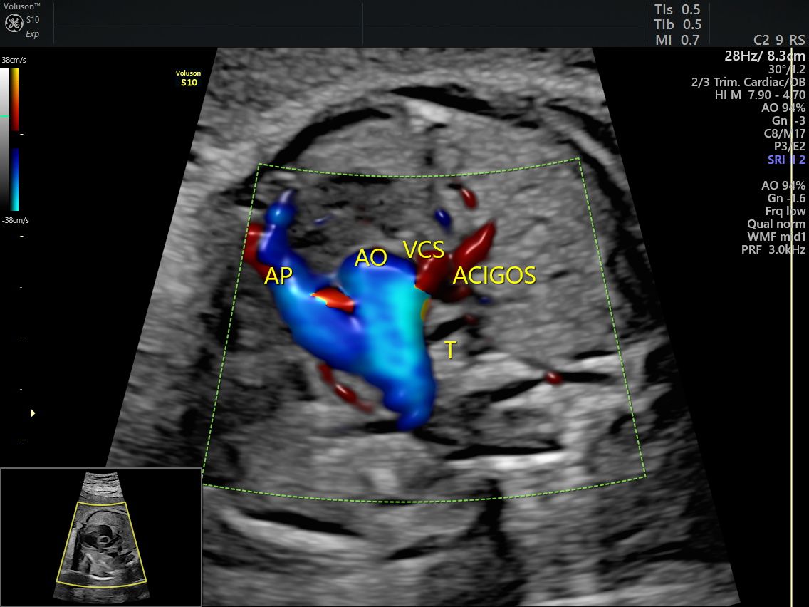 Cinthia Naxhiely Toledo Lorenzo-8