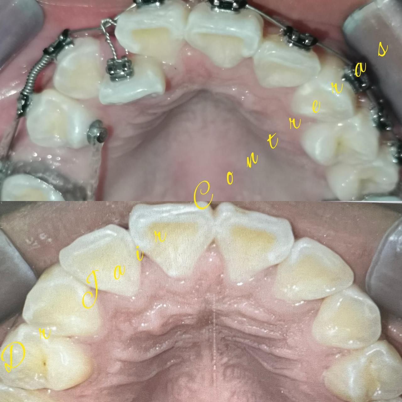 Jair Contreras García-11