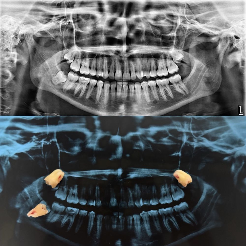 Itzel Abigail Montiel Garces-10