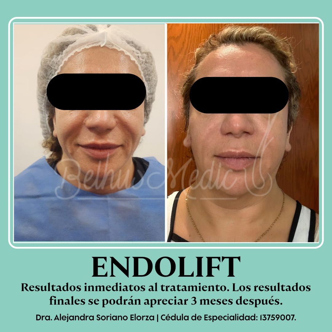 Alejandra Soriano Elorza-16