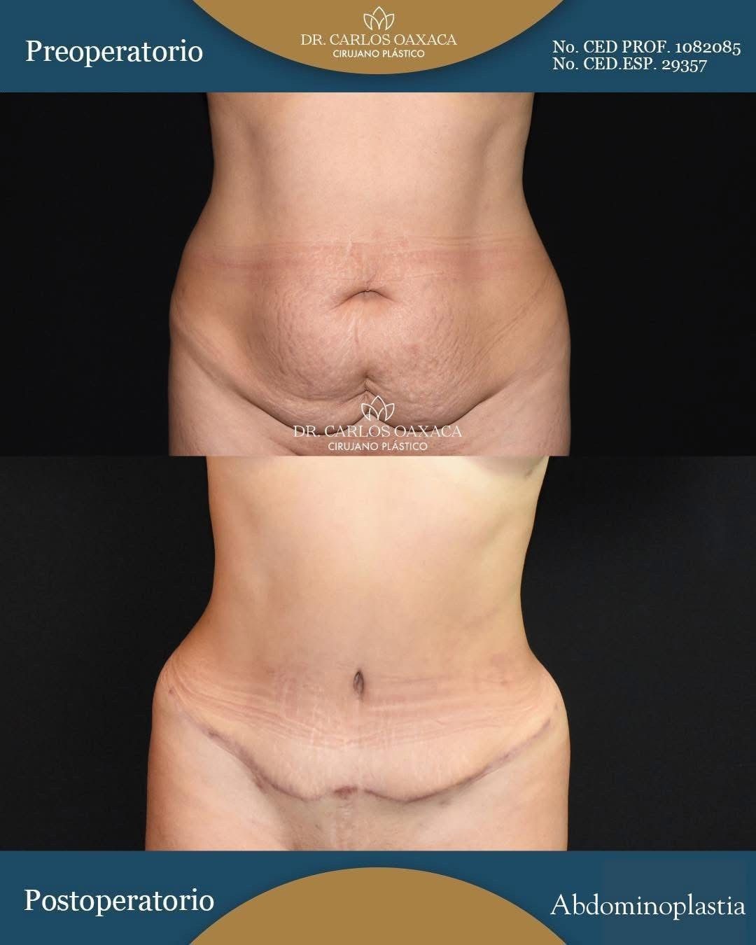 Carlos Guillermo Oaxaca Escobar-3