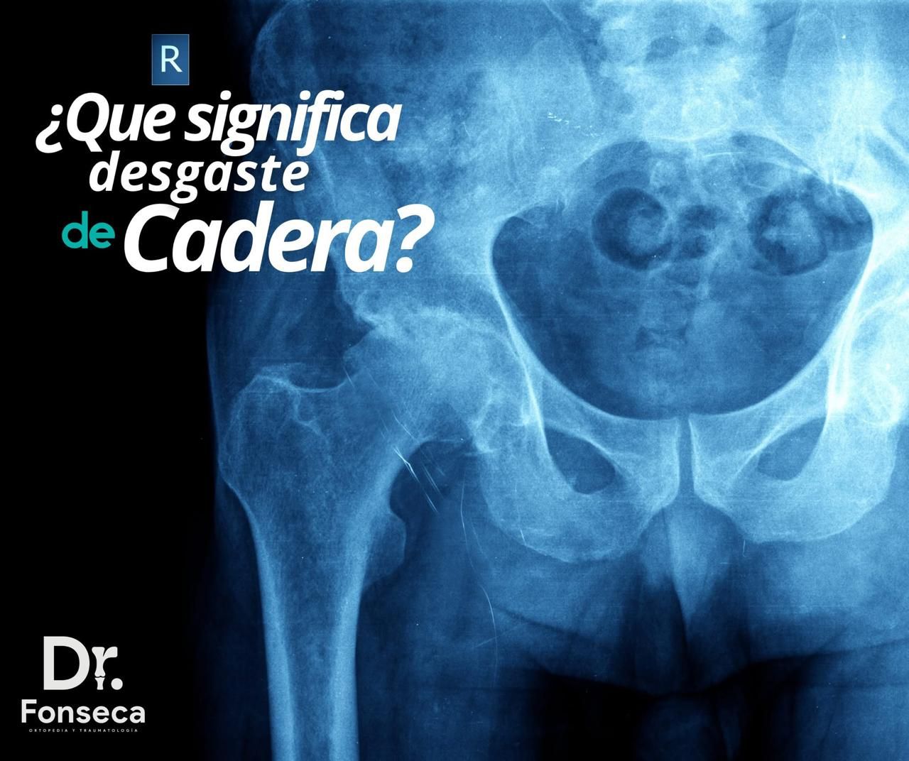 Andres Fonseca G.-9