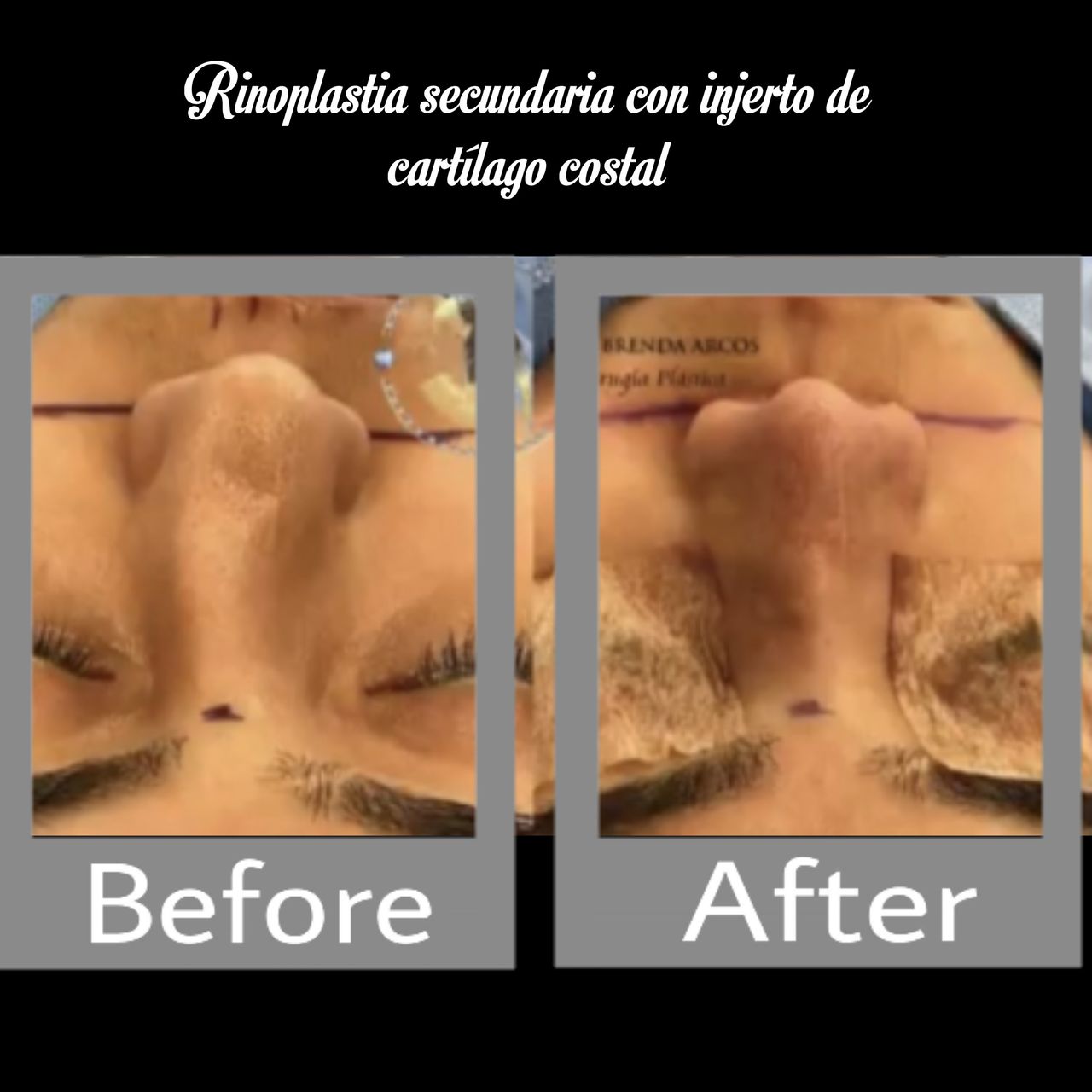 Brenda Arcos Vera-46