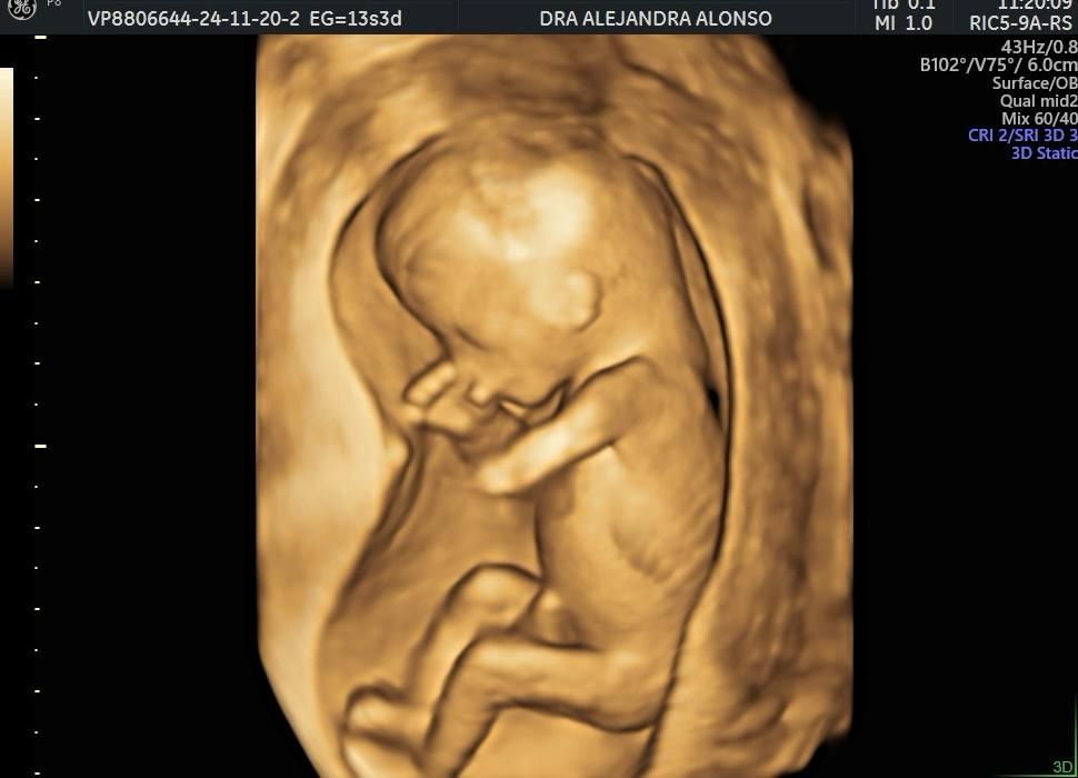 Alejandra Alonso Martínez-2