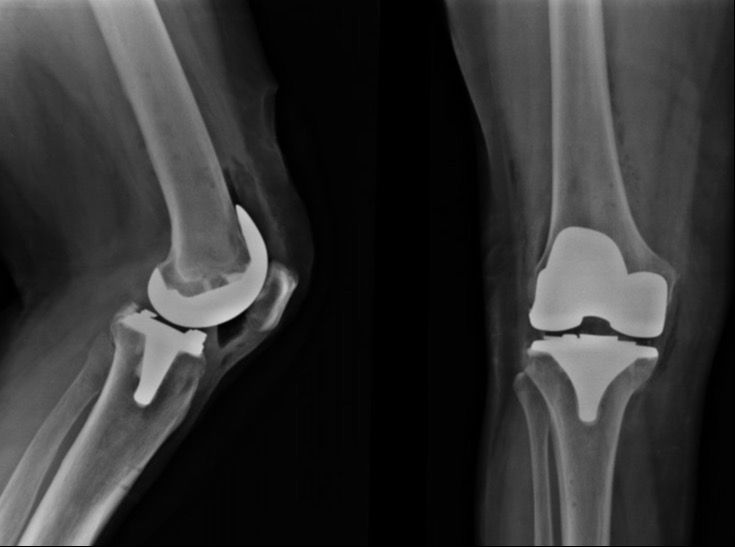 Alejandra Fuentes Martínez-9