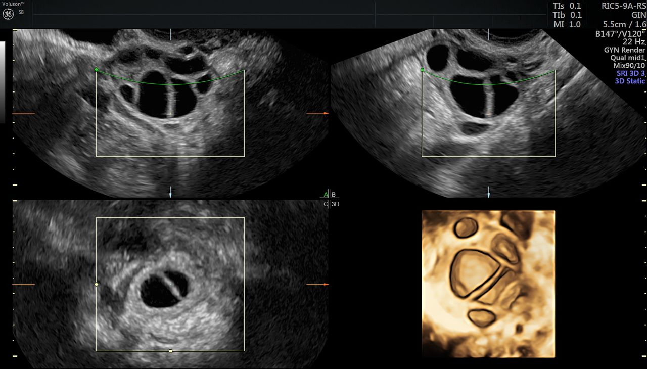 Griselda Reyes Torres-76